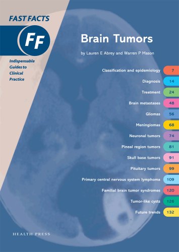 Stock image for Fast Facts: Brain Tumors (Fast Facts) for sale by WorldofBooks