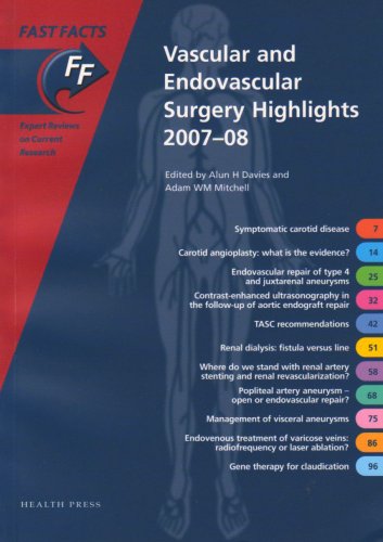 Beispielbild fr Fast Facts: Vascular and Endovascular Surgery Highlights 2007-08 zum Verkauf von Anybook.com