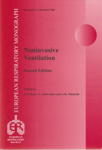 9781904097624: Noninvasive Ventilation (ERS Monograph)