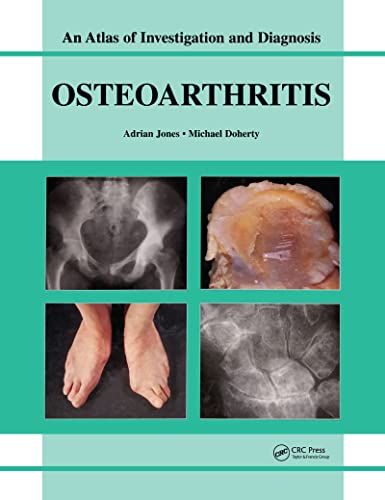Stock image for Oesteoarthritis for sale by Books Puddle
