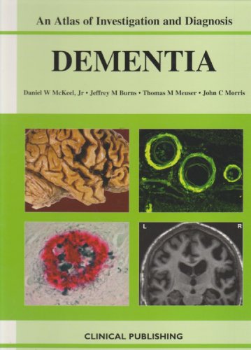 Beispielbild fr Dementia, an Atlas of Investigation and Diagnosis zum Verkauf von Better World Books