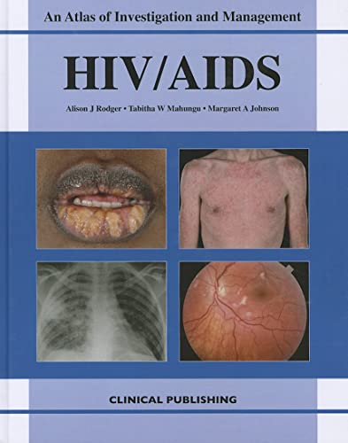 Stock image for HIV/AIDS : An Atlas of Investigation and Management for sale by Better World Books: West