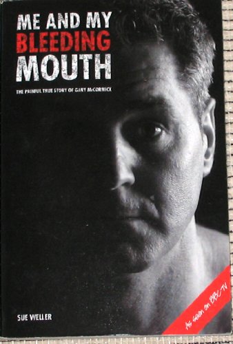 Beispielbild fr ME AND MY BLEEDING MOUTH PB: The Painful Story of Gary McCormick zum Verkauf von WorldofBooks