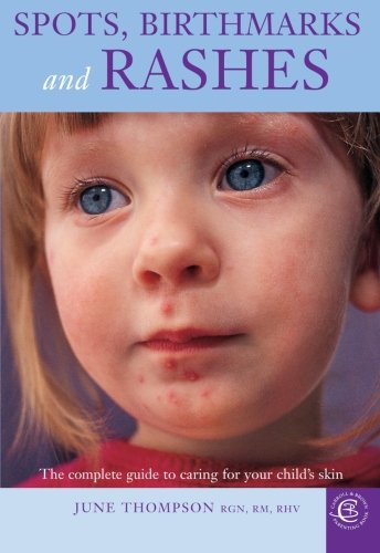 9781904760375: Spots, Birthmarks and Rashes: Concentrates on the causes and treatment of children's skin conditions