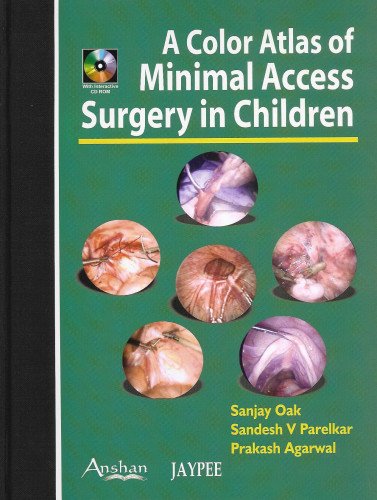 Imagen de archivo de Colour Atlas of Minimal Access Surgery in Children a la venta por BookstoYou