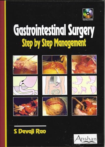 Beispielbild fr Gastrointestinal Surgery: Step by Step Management zum Verkauf von Books Puddle