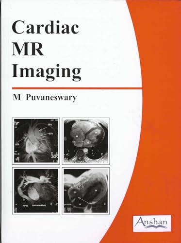 Beispielbild fr Cardiac MR Imaging zum Verkauf von Hay-on-Wye Booksellers