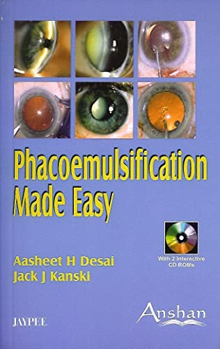 9781904798651: Phacoemulsification Made Easy