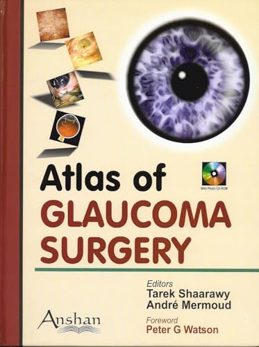 Stock image for Atlas of Glaucoma Surgery for sale by PAPER CAVALIER UK