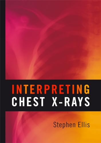 Beispielbild fr Interpreting Chest X-rays zum Verkauf von WorldofBooks