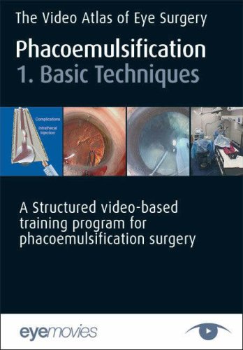 The Video Atlas of Eye Surgery (v. 1) (9781905312016) by Brian Little; Larry Benjamin; Mark Packer