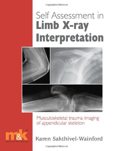 Stock image for Self-Assessment in Limb X-Ray Interpretation : Musculoskeletal Trauma Imaging of Appendicular Skeleton for sale by Better World Books Ltd