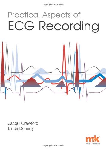 Stock image for Practical Aspects of ECG Recording for sale by Better World Books Ltd