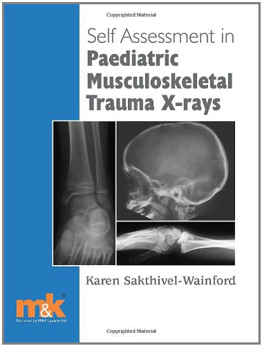 Stock image for Self-Assessment in Paediatric Musculoskeletal Trauma X-Rays for sale by Better World Books Ltd