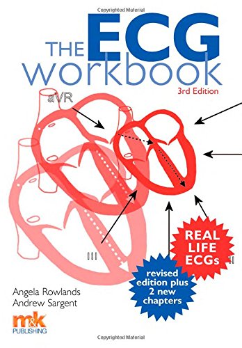 Stock image for The ECG Workbook 3/ed (3rd Edition) for sale by AwesomeBooks