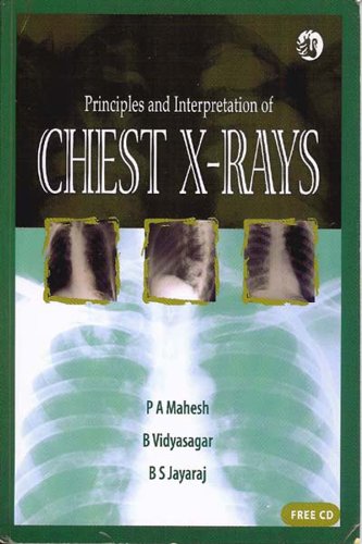 Imagen de archivo de Principles and Interpretation of Chest X-Rays [With CDROM] a la venta por ThriftBooks-Atlanta