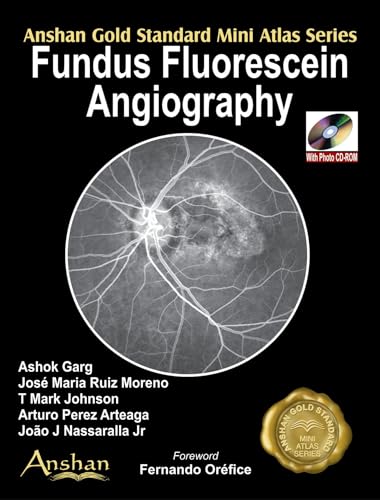 Stock image for Fundus Fluorescein Angiography (Anshan Gold Standard Mini Atlas) for sale by GF Books, Inc.