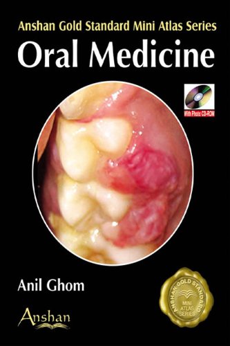 Beispielbild fr Mini Atlas Of Oral Medicine (Anshan Gold Standard Mini Atlas) zum Verkauf von suffolkbooks