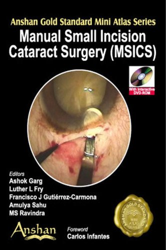 Stock image for Mini Atlas of Manual Small Incisions in Cateract Surgery for sale by Books Puddle