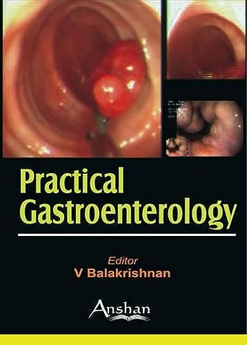 Stock image for Practical Gastroenterology for sale by Anybook.com