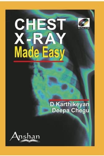 Beispielbild fr Chest X-Ray Made Easy zum Verkauf von Better World Books