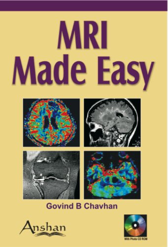 Beispielbild fr MRI Made Easy zum Verkauf von Anybook.com