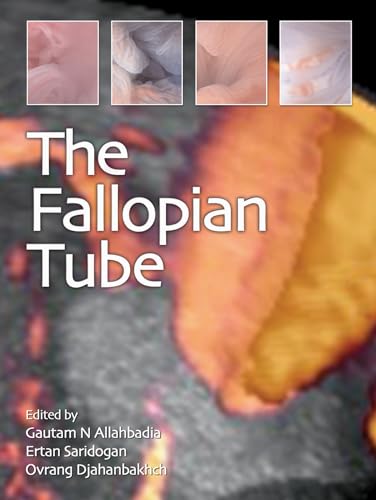 Stock image for The Fallopian Tube for sale by Majestic Books
