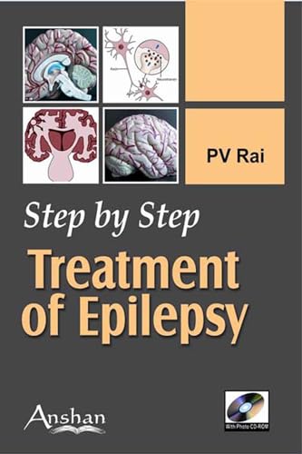 Stock image for Step by Step: Treatment of Epilepsy (Step by Step (Anshan)) for sale by suffolkbooks