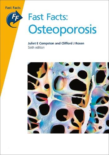 Stock image for Osteoporosis for sale by Better World Books Ltd