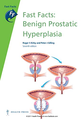 Fast Facts: Benign Prostatic Hyperplasia (9781905832927) by Peter J Gilling; Roger S Kirby