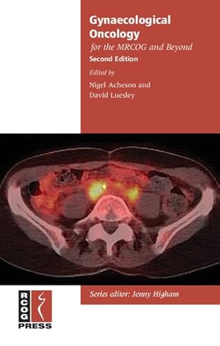 9781906985219: Gynaecological Oncology for the MRCOG and Beyond (Membership of the Royal College of Obstetricians and Gynaecologists and Beyond)