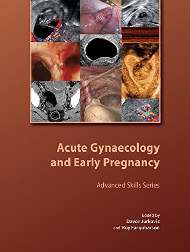 Stock image for Acute Gynaecology and Early Pregnancy (Royal College of Obstetricians and Gynaecologists Advanced Skills) for sale by Academybookshop