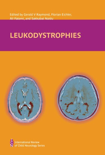 9781907655098: Leukodystrophies: 2 (International Review of Child Neurology)