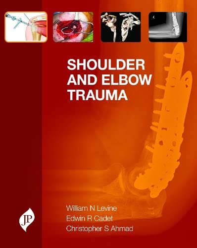 Beispielbild fr Shoulder and Elbow Trauma zum Verkauf von Learnearly Books