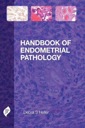 Stock image for Handbook of Endometrial Pathology for sale by TextbookRush