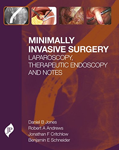 Imagen de archivo de Minimally Invasive Surgery: Laparoscopy, Therapeutic Endoscopy and Notes a la venta por Chiron Media