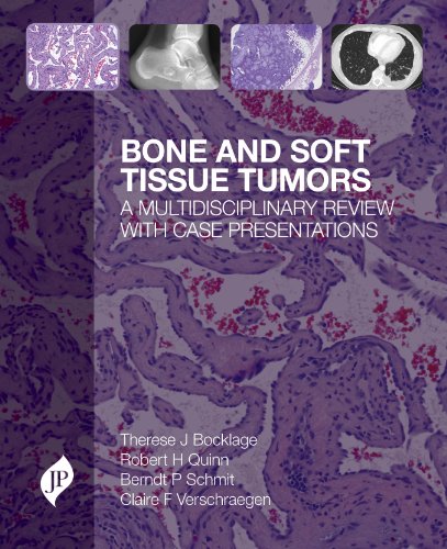 Beispielbild fr Bone and Soft Tissue Tumors zum Verkauf von Chiron Media