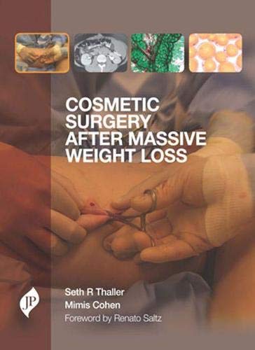 Stock image for Cosmetic Surgery After Massive Weight Loss for sale by Learnearly Books