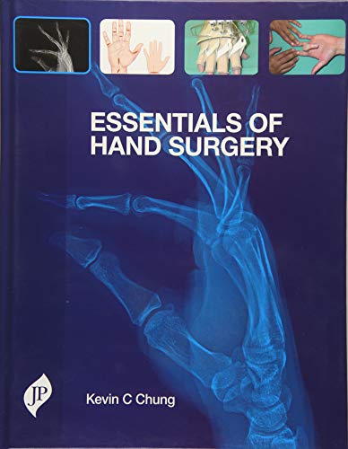 Imagen de archivo de Essentials of Hand Surgery 1st Edition a la venta por Basi6 International