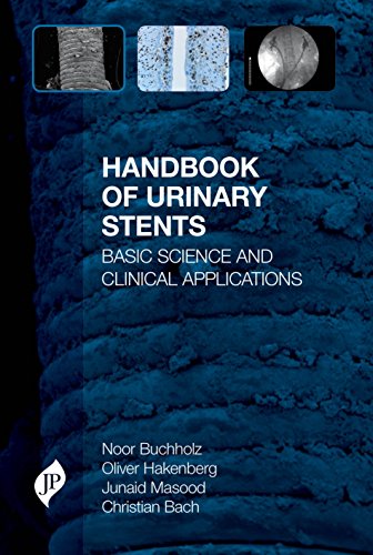 9781907816659: Handbook of Urinary Stents: Basic Science and Clinical Applications