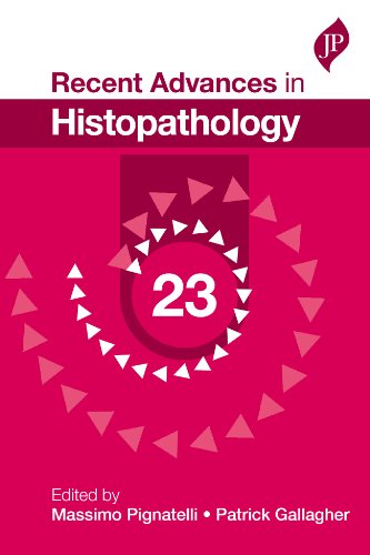 Recent Advances in Histopathology: 23 (9781907816857) by Pignatelli, Massimo