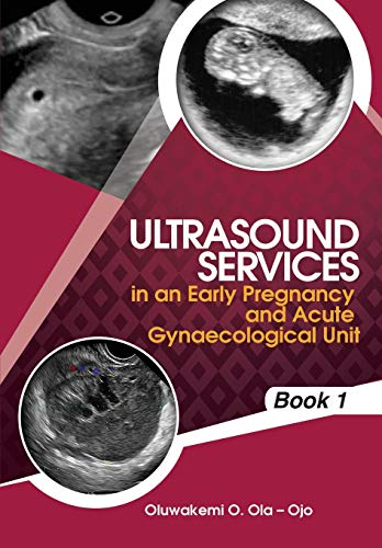 Beispielbild fr Ultrasound Services in An Early Pregnancy and Acute Gynaecological Unit Book1 zum Verkauf von PBShop.store US