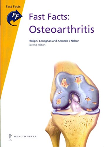 Imagen de archivo de Osteoarthritis a la venta por Better World Books