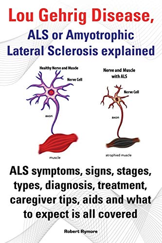 Beispielbild fr Lou Gehrig Disease, ALS or Amyotrophic Lateral Sclerosis Explained. ALS Symptoms, Signs, Stages, Types, Diagnosis, Treatment, Caregiver Tips, AIDS and zum Verkauf von Goodwill of Colorado