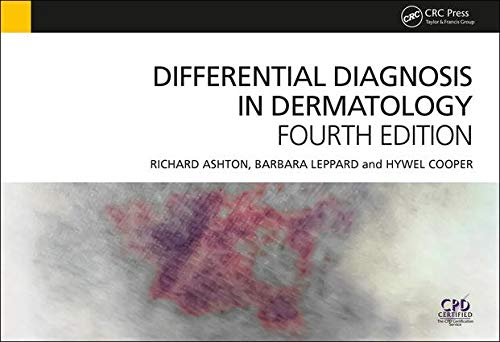 Imagen de archivo de Differential Diagnosis in Dermatology a la venta por Goodwill Southern California