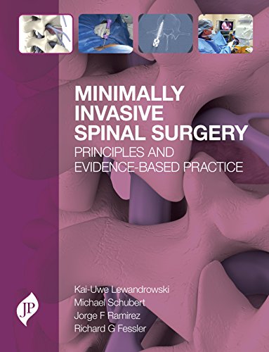 Stock image for Minimally Invasive Spinal Surgery: Principles and Evidence-Based Practice for sale by Books Puddle