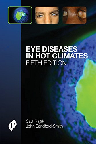 Beispielbild fr Eye Diseases in Hot Climates zum Verkauf von Monster Bookshop