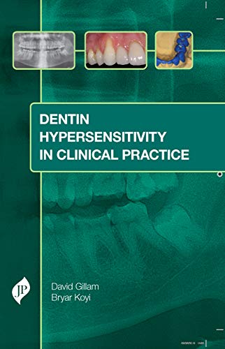 Beispielbild fr Dentin Hypersensitivity in Clinical Practice zum Verkauf von WorldofBooks