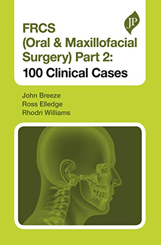Stock image for Frcs (Oral & Maxillofacial Surgery) Part 2: 100 Clinical Cases for sale by Majestic Books