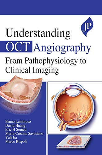 Stock image for UNDERSTANDING OCT ANGIOGRAPHY FROM PATHOPHYSIOLOGY TO CLINICAL IMAGING for sale by Basi6 International